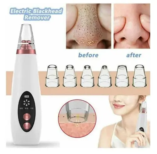 ব্ল্যাকহেড রিমুভার মেশিন | Blackhead Remover Machine 6 In 1 Rechargeable